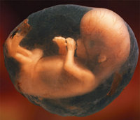 Image of a human baby in-utero C00