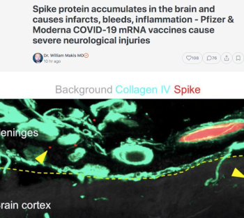 Image of Covid Spike protein crossing the blood brain barrier